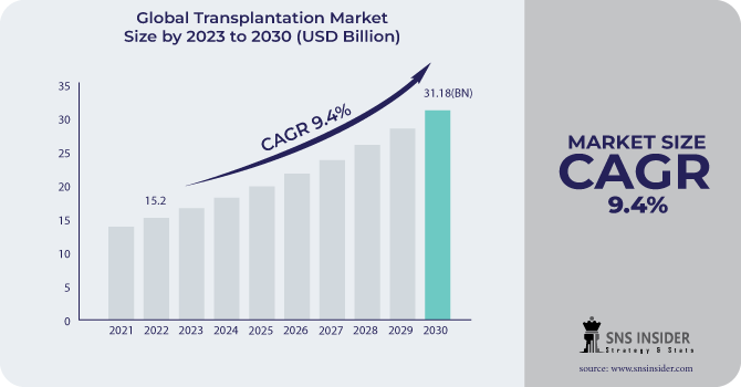 Transplantation Market Revenue Analysis