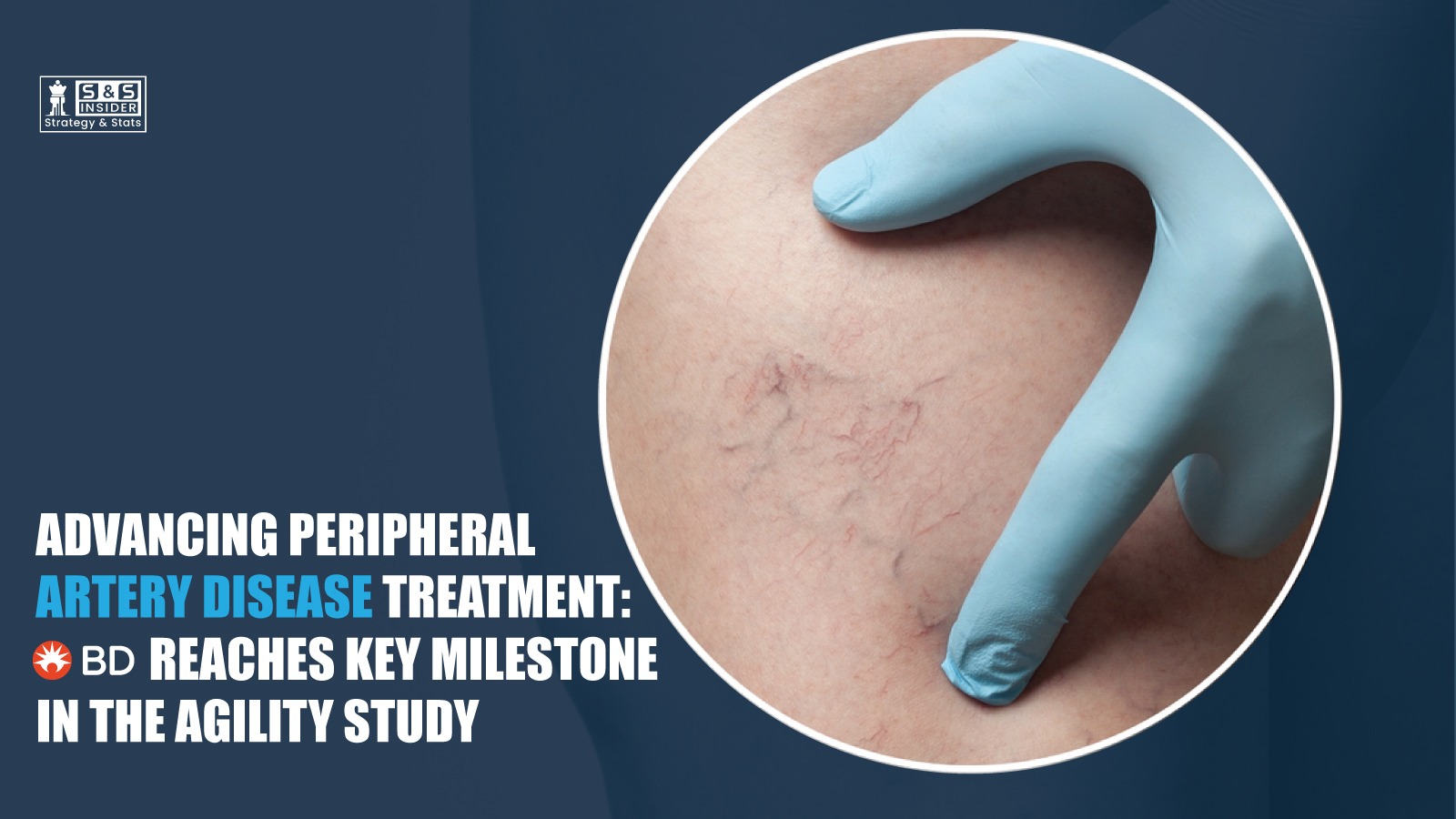 Peripheral Artery Disease Treatment 