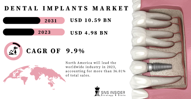 Dental Implants Market Size Share Global Statistics 2031 Dental Implants Market Size Share Global Statistics 2031