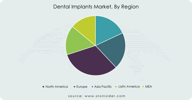 Dental-Implants-Market-By-Region