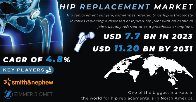 Hip Replacement Market Revenue Analysis