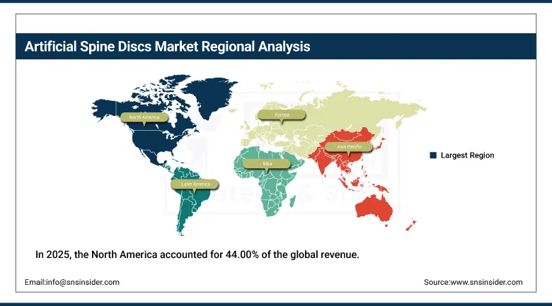 Artificial Spine Discs Market Share By Region