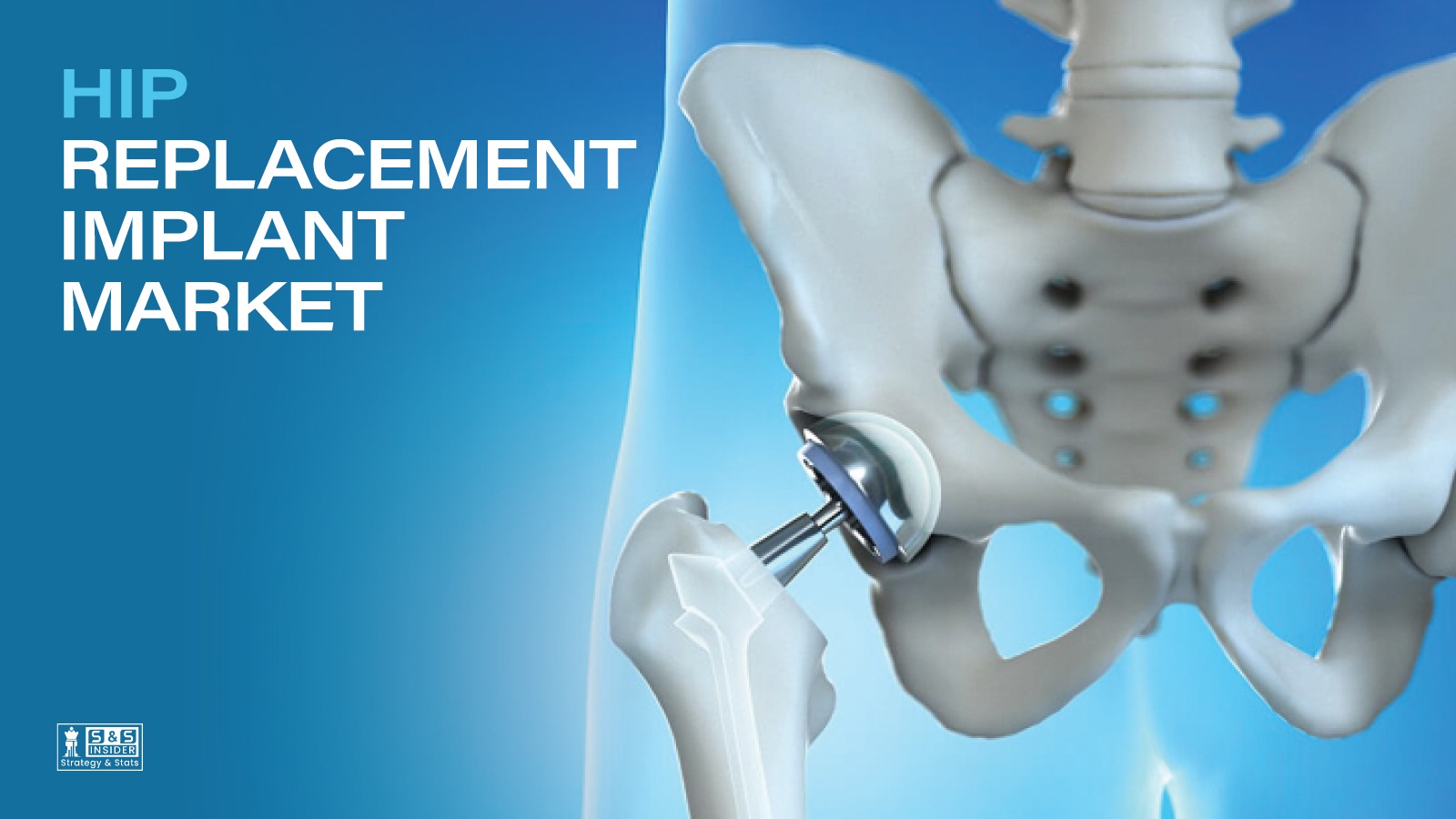 The Growing Role Of Robotic Technology In Hip Replacement Surgery