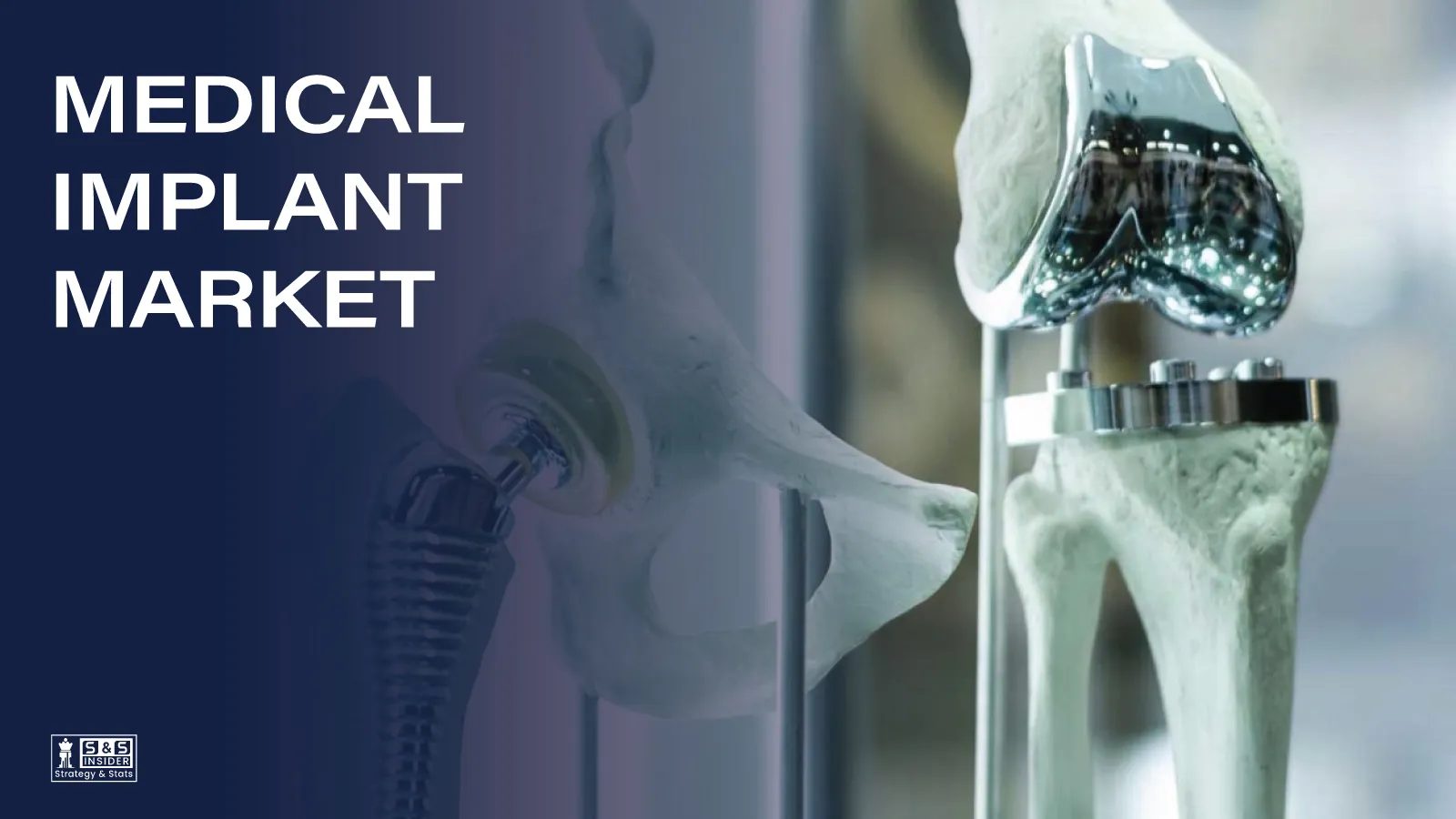 How Medical Implants Are Transforming Modern Healthcare