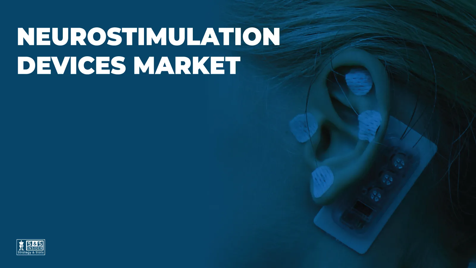 Neurostimulation Devices Market