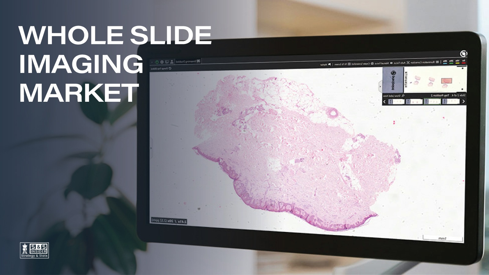Whole Slide Imaging Market