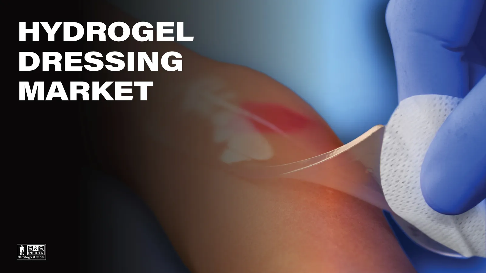 Europe Hydrogel Dressing Market Europe Hydrogel Dressing Market